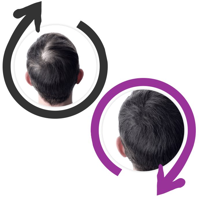 Hairtivator